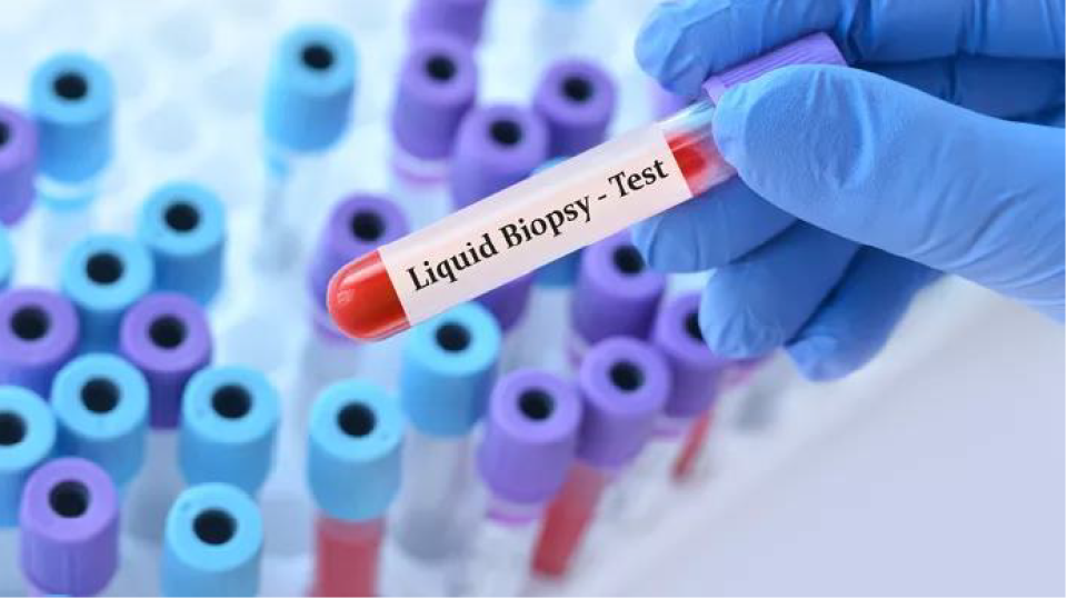 Liquid Biopsy